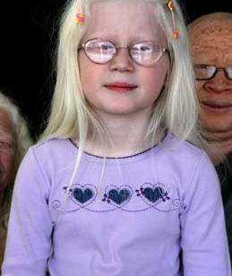 470_albino_air.jpg