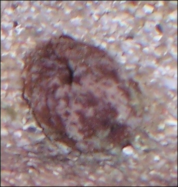 worm1.JPG worm1.JPG