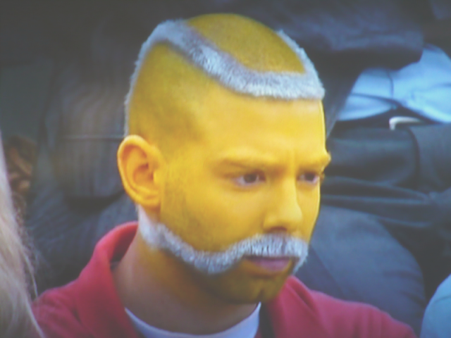 tennis_ball_hair_style_-_bad_hair_cut_or_funky_idea.png