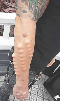 skin bumps.jpg