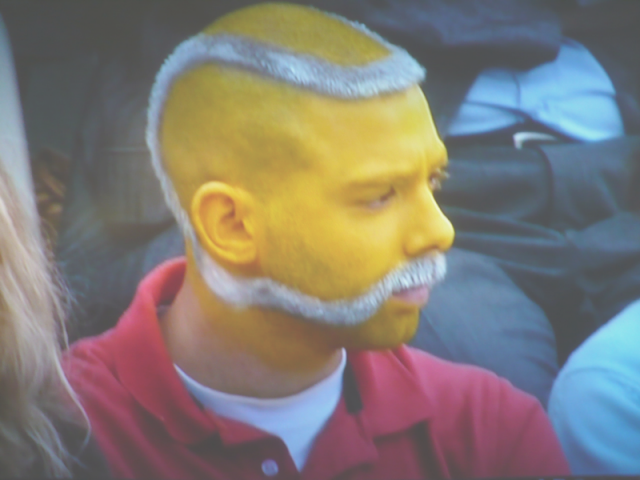 tennis ball hair cut - innovative or weird.png tennis ball hair cut - innovative or weird.png