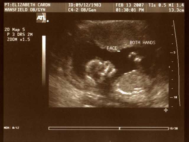 ultrasound007.jpg